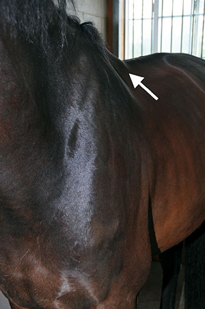 In this case the trapezius muscle can also become inflamed like this bulge under the saddle when the tree angle is too wide or too narrow and also causing atrophy in the area.